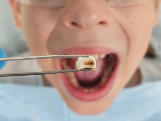 Best Tooth Pain Emergency Relief  in Clay Center, KS