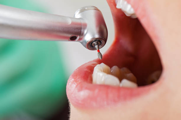Best Tooth Pain Emergency Relief  in Clay Center, KS